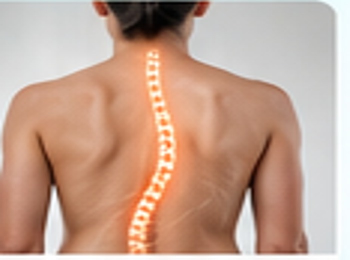 Escoliosis