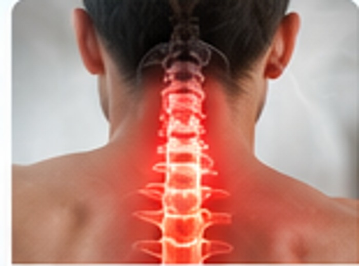 Rectificación cervical